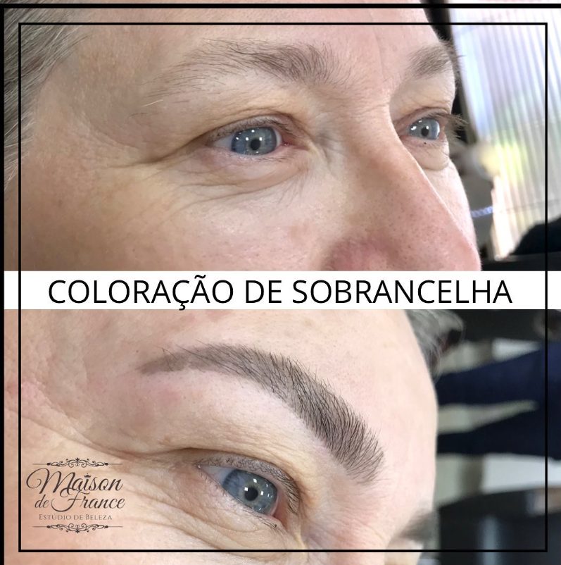 Antes e depois de coloração de sobrancelha: acima, sobrancelha clara e falhada; abaixo, sobrancelha preenchida e definida